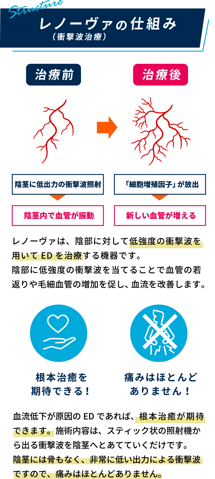 レノーヴァの仕組み